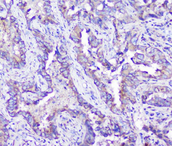ARSA Mouse Monoclonal Antibody