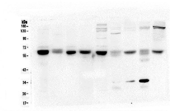 ARSA Mouse Monoclonal Antibody