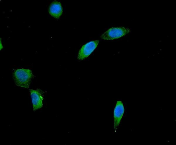 AES Rabbit Polyclonal Antibody