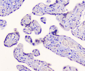 AES Rabbit Polyclonal Antibody