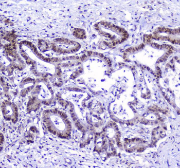 AHR Rabbit Polyclonal Antibody