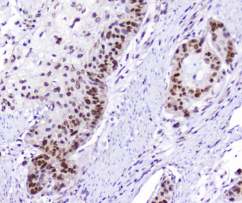 AHR Rabbit Polyclonal Antibody