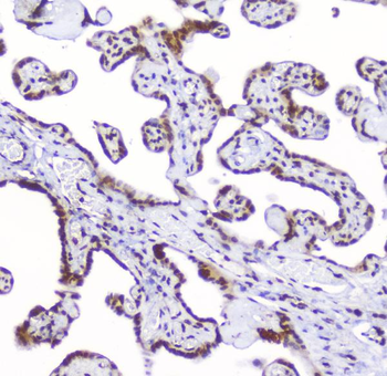 AHR Rabbit Polyclonal Antibody