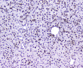 AHR Rabbit Polyclonal Antibody