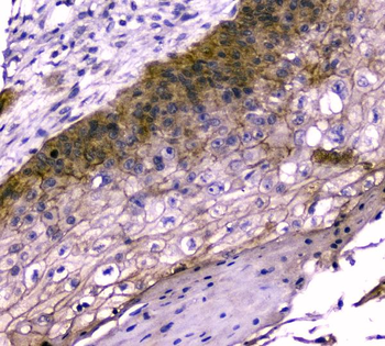 TMEM16A/ANO1 Rabbit Polyclonal Antibody