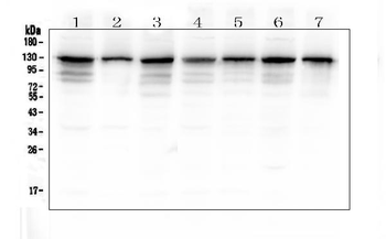 TMEM16A/ANO1 Rabbit Polyclonal Antibody