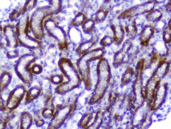 Amphiregulin/Areg Rabbit Polyclonal Antibody