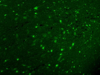 Calbindin/CALB1 Rabbit Polyclonal Antibody