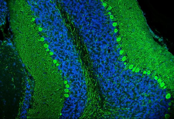 Calbindin/CALB1 Rabbit Polyclonal Antibody