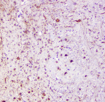 Calbindin/CALB1 Rabbit Polyclonal Antibody