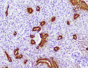 Calbindin/CALB1 Rabbit Polyclonal Antibody
