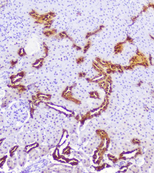 Calbindin/CALB1 Rabbit Polyclonal Antibody