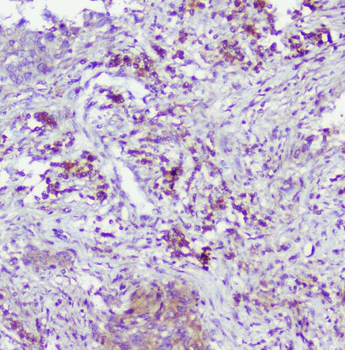 Caspase-2/CASP2 Rabbit Polyclonal Antibody
