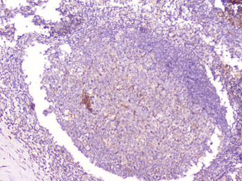 CD1b Rabbit Polyclonal Antibody