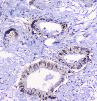 CFP Rabbit Polyclonal Antibody