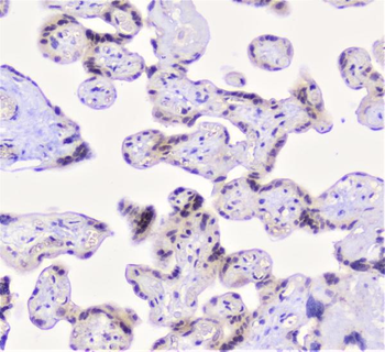 CFP Rabbit Polyclonal Antibody