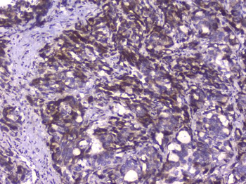 CIC Rabbit Polyclonal Antibody