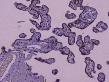 CIC Rabbit Polyclonal Antibody