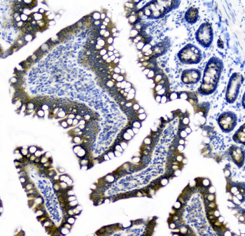 CIC Rabbit Polyclonal Antibody