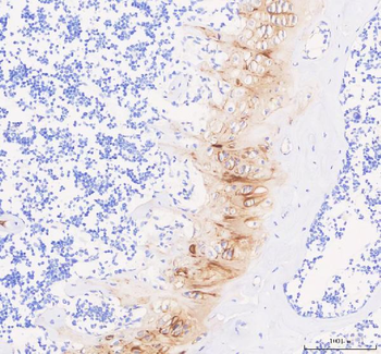 COMP Rabbit Polyclonal Antibody