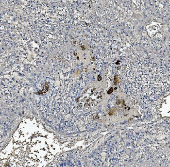 C Reactive Protein/CRP Antibody