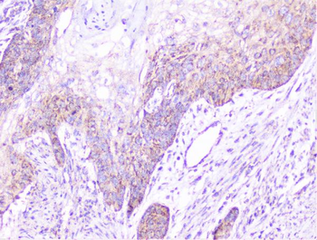 Cortactin/CTTN Rabbit Polyclonal Antibody