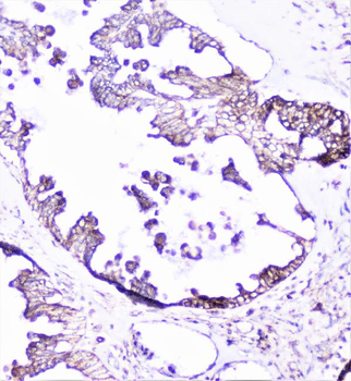 Cortactin/CTTN Rabbit Polyclonal Antibody