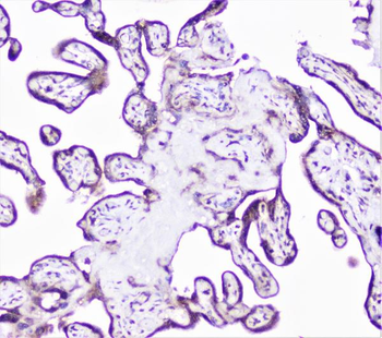 Cortactin/CTTN Rabbit Polyclonal Antibody