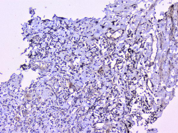 Cortactin/CTTN Rabbit Polyclonal Antibody