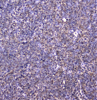 Cortactin/CTTN Rabbit Polyclonal Antibody