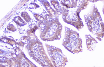 Cortactin/CTTN Rabbit Polyclonal Antibody