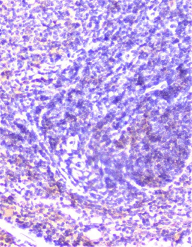 Cortactin/CTTN Rabbit Polyclonal Antibody