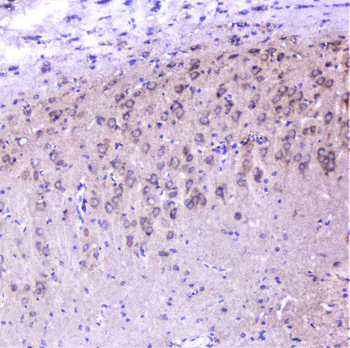 Cortactin/CTTN Rabbit Polyclonal Antibody