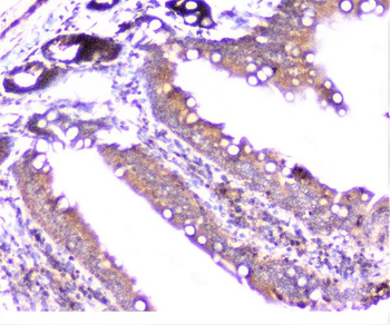 Cortactin/CTTN Rabbit Polyclonal Antibody