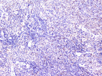 Cortactin/CTTN Rabbit Polyclonal Antibody