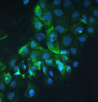 Cortactin/CTTN Rabbit Polyclonal Antibody