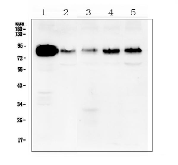 Cortactin/CTTN Rabbit Polyclonal Antibody