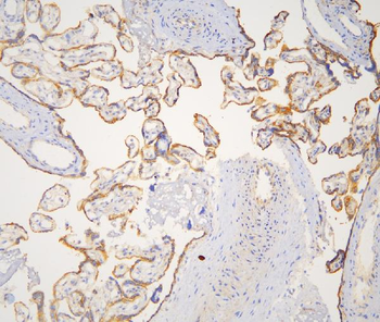 Cortactin/CTTN Rabbit Polyclonal Antibody