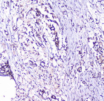 Cortactin/CTTN Rabbit Polyclonal Antibody