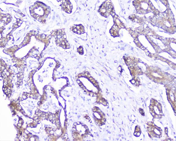 Cortactin/CTTN Rabbit Polyclonal Antibody