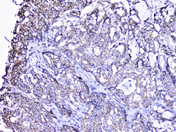 Cortactin/CTTN Rabbit Polyclonal Antibody