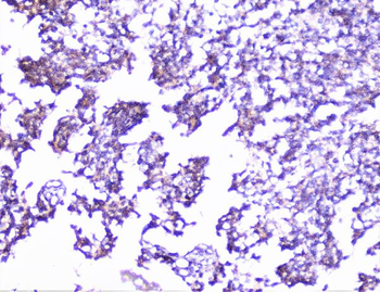 Cortactin/CTTN Rabbit Polyclonal Antibody