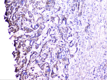 Cortactin/CTTN Rabbit Polyclonal Antibody
