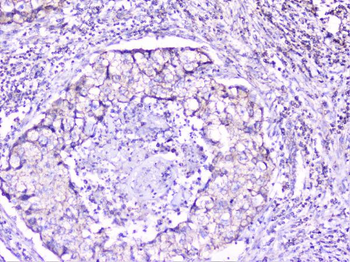 Cortactin/CTTN Rabbit Polyclonal Antibody