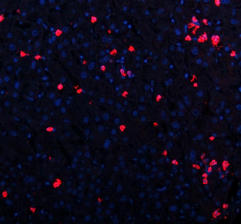 CXCL12 Rabbit Polyclonal Antibody
