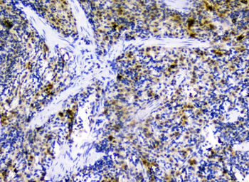 CXCL12 Rabbit Polyclonal Antibody