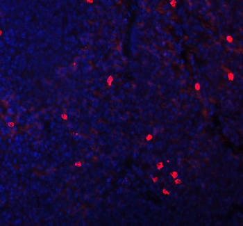 CXCL12 Rabbit Polyclonal Antibody