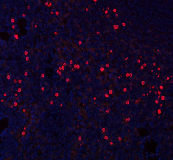 CXCL12 Rabbit Polyclonal Antibody