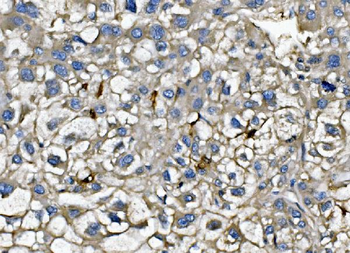 CXCL12 Rabbit Polyclonal Antibody