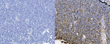 CXCL12 Rabbit Polyclonal Antibody